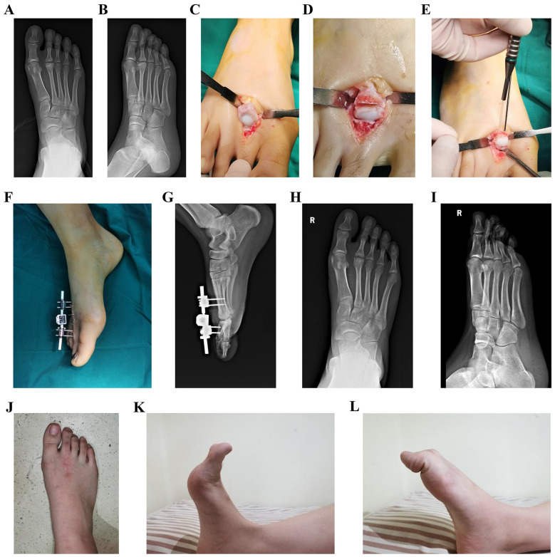 Figure 3