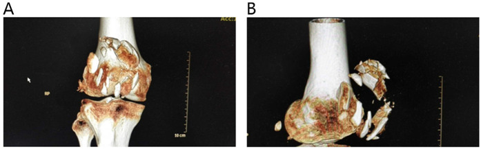 Figure 1