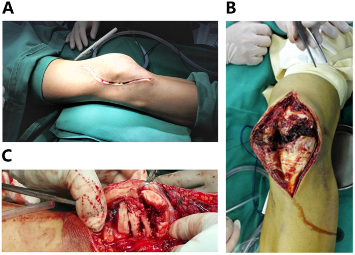 Figure 2