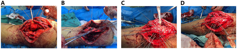 Figure 3