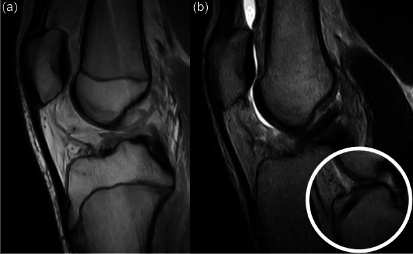 Figure 18