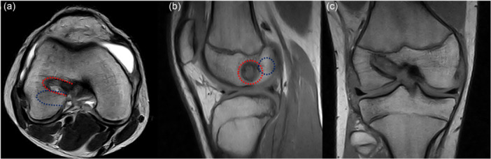 Figure 13