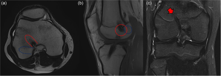 Figure 14