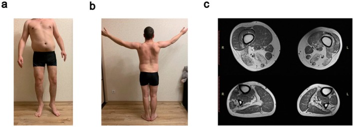 FIGURE 2