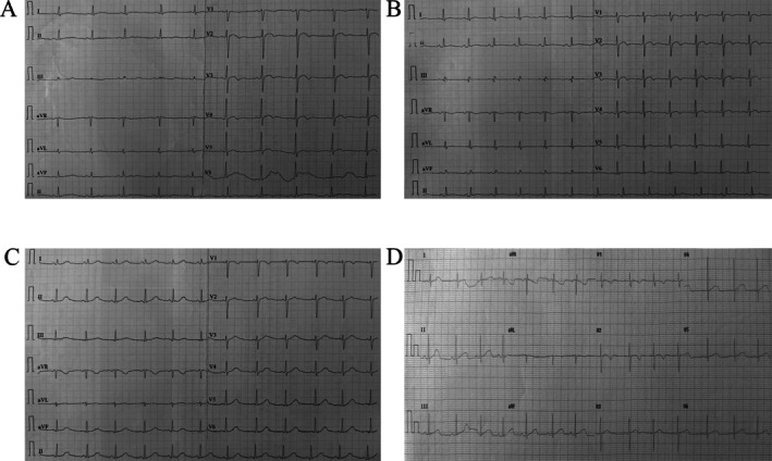 FIGURE 2