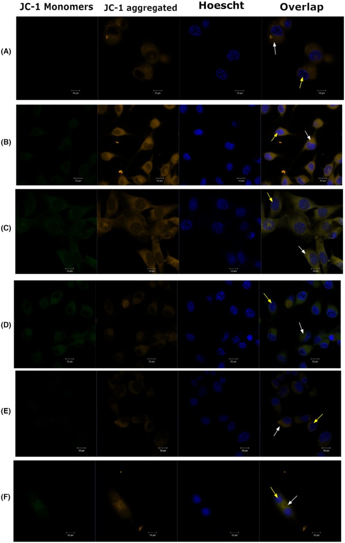 FIGURE 1