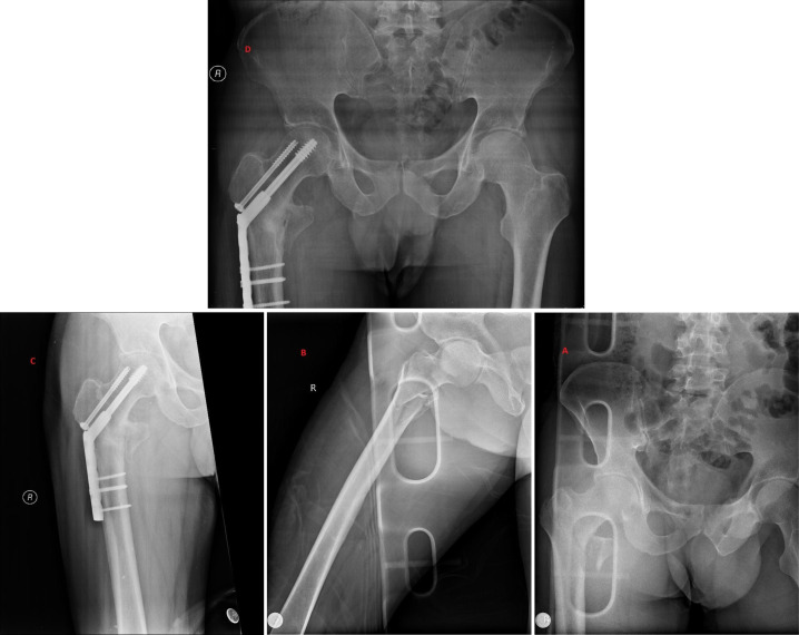 Figure 2