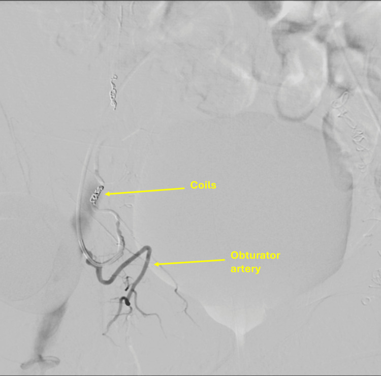 Figure 9