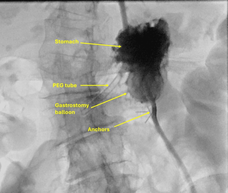 Figure 10