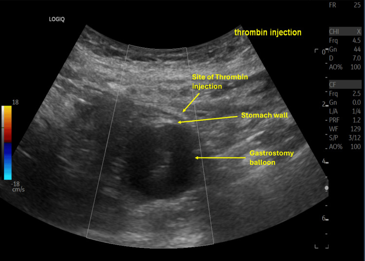 Figure 11
