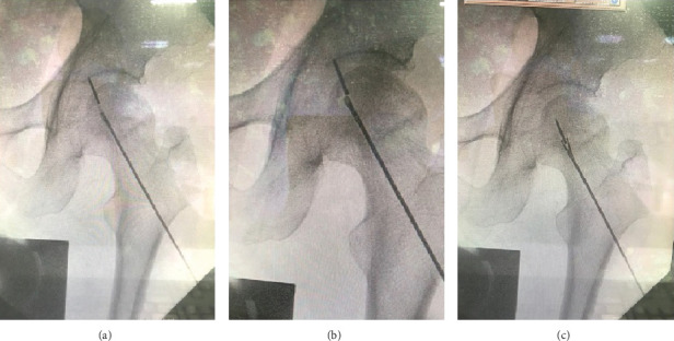 Figure 5
