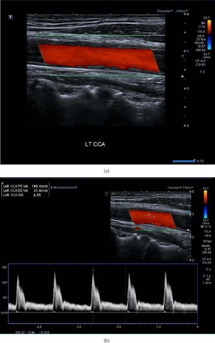 Figure 5
