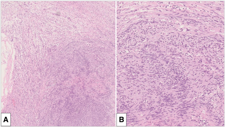 Fig. 4
