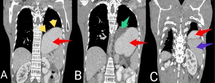 FIGURE 3