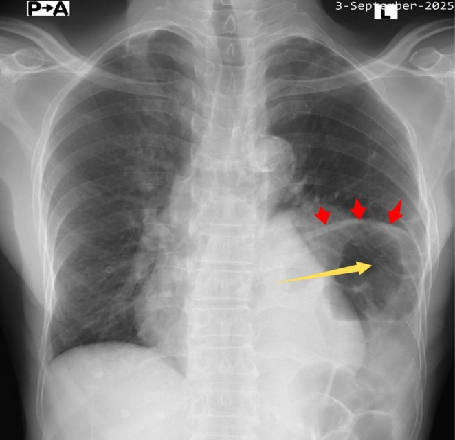 FIGURE 2