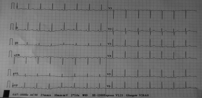 FIGURE 1