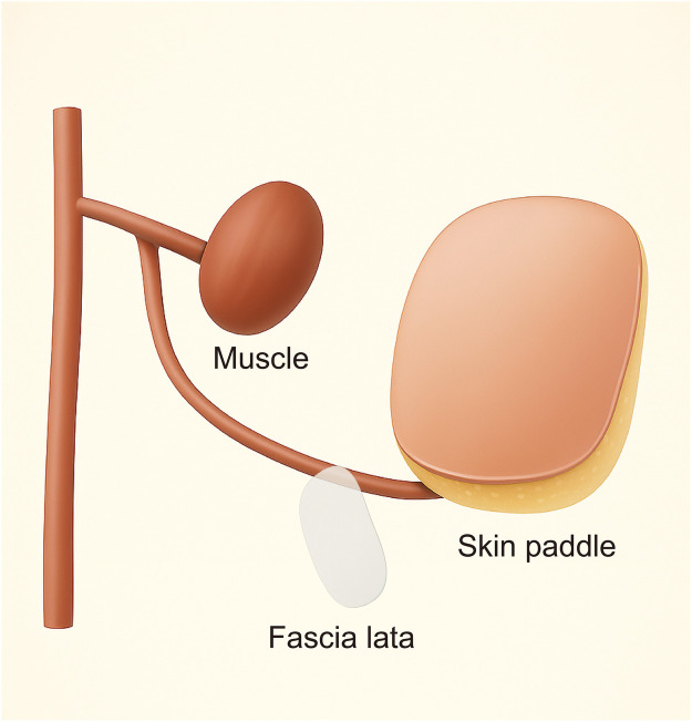 Figure 1