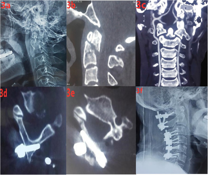 Figure 3