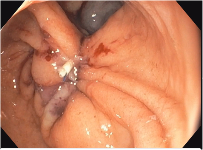 Figure 7