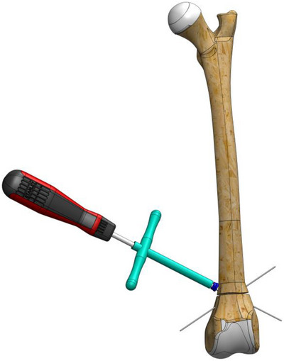 FIGURE 3