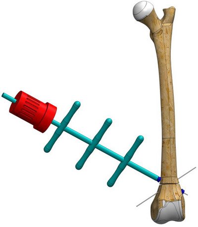 FIGURE 4