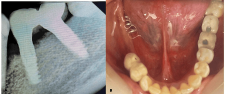 Figure 9