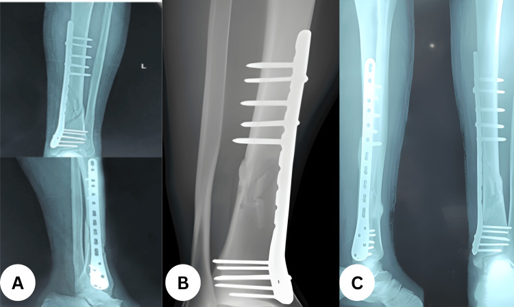 Figure 4