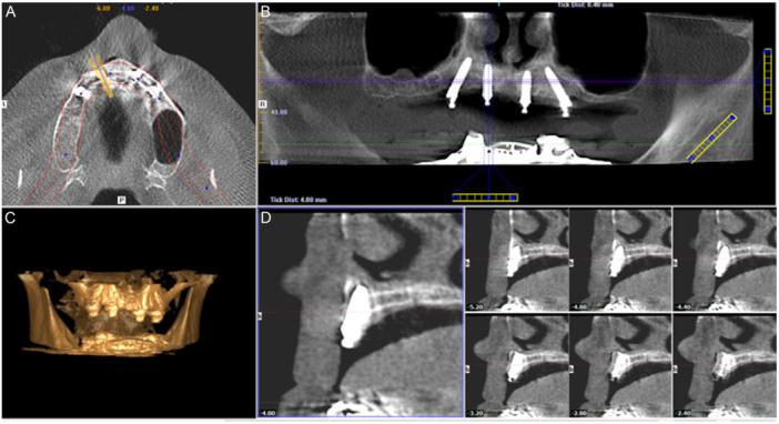 Figure 2