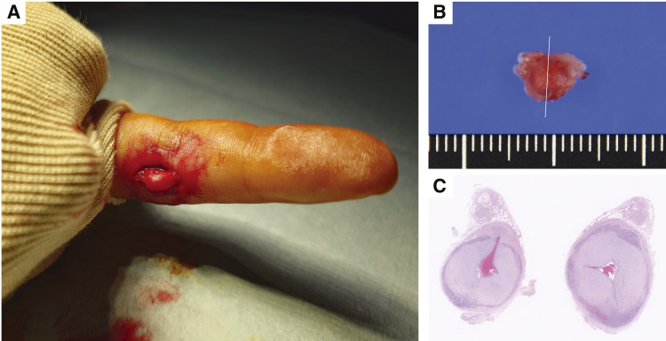 Fig. 2