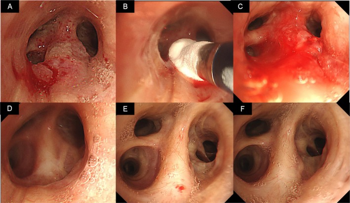 FIGURE 2