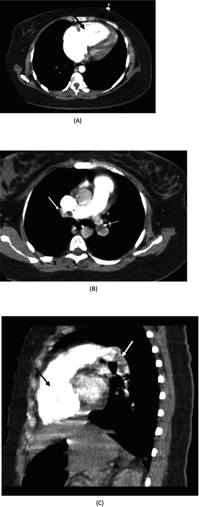FIGURE 1
