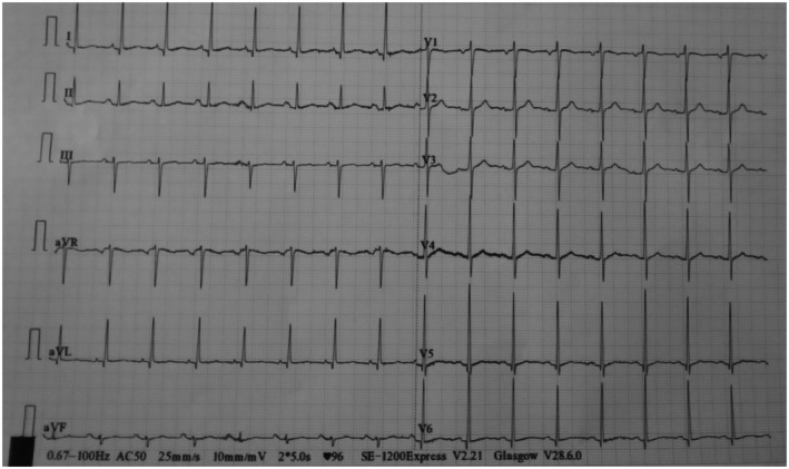 FIGURE 1