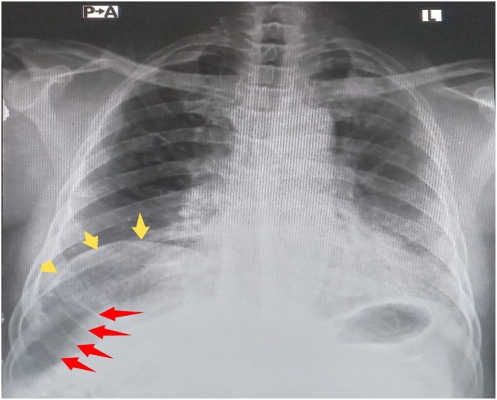 FIGURE 2
