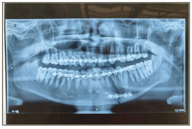 Figure 7