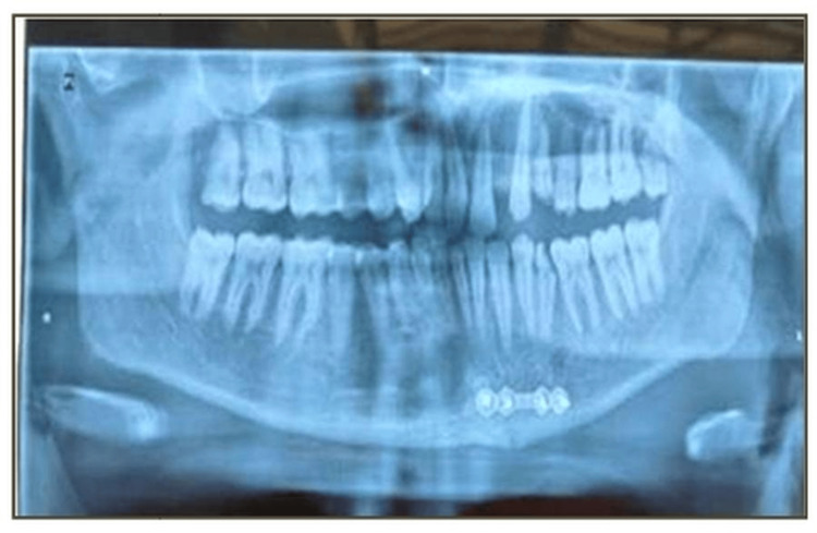 Figure 9