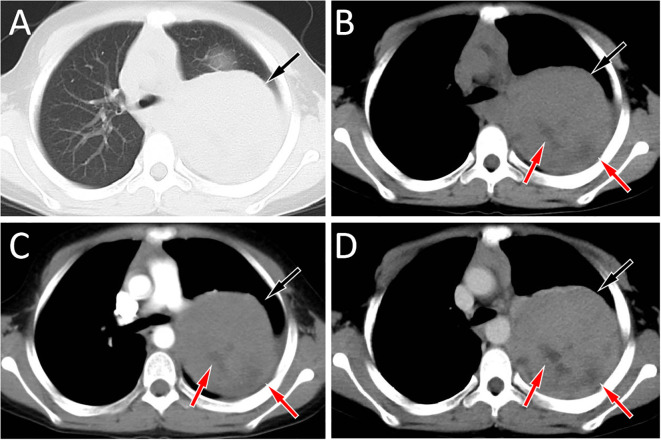 Figure 1