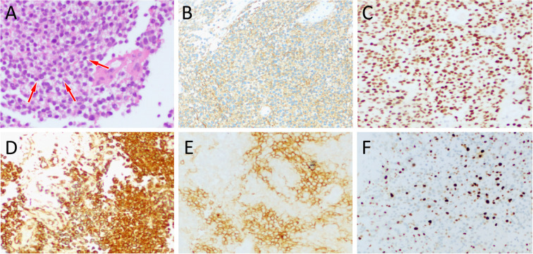Figure 3