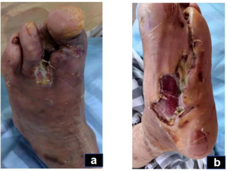 Figure 3