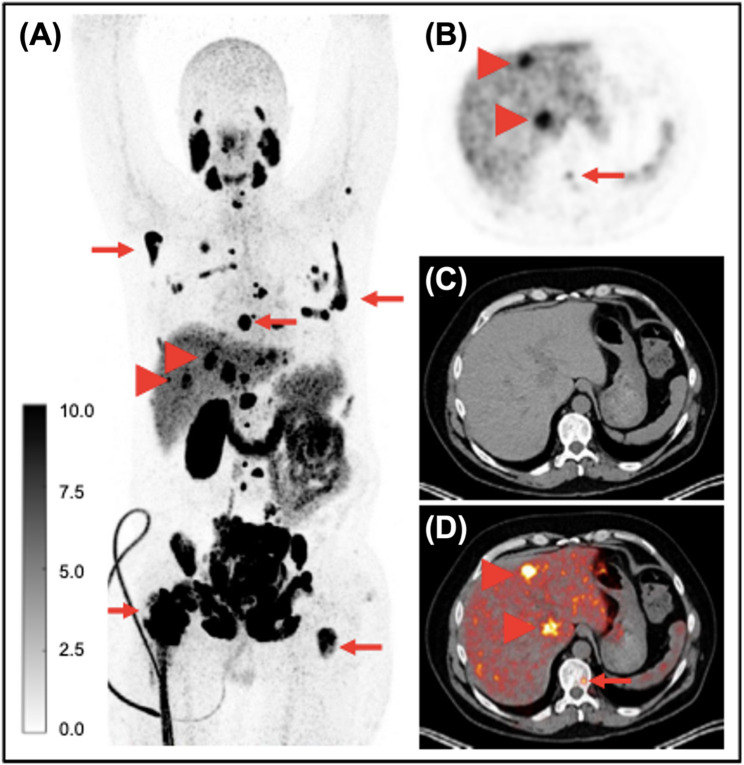 Figure 10