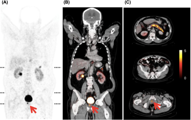 Figure 14