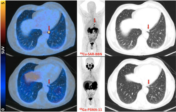 Figure 15