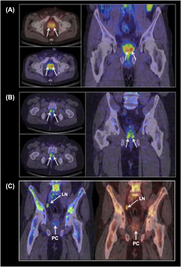 Figure 16