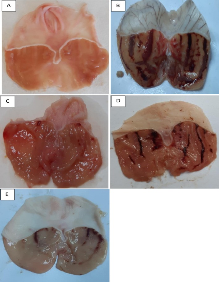 Figure 5
