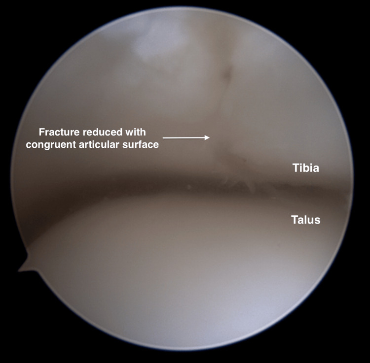 Figure 9