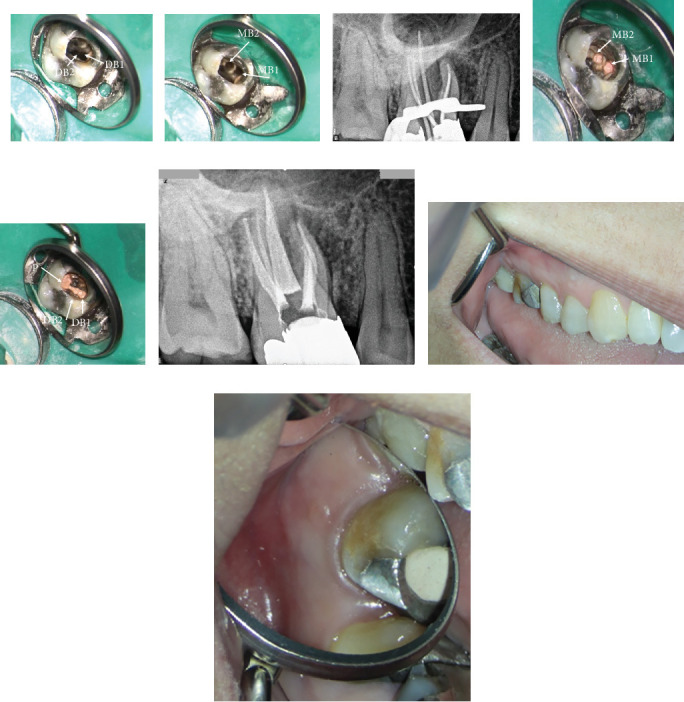 Figure 11