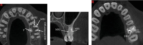 Figure 14