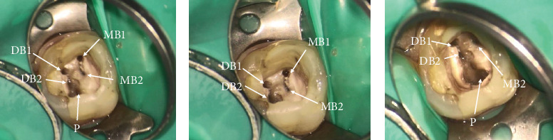 Figure 15