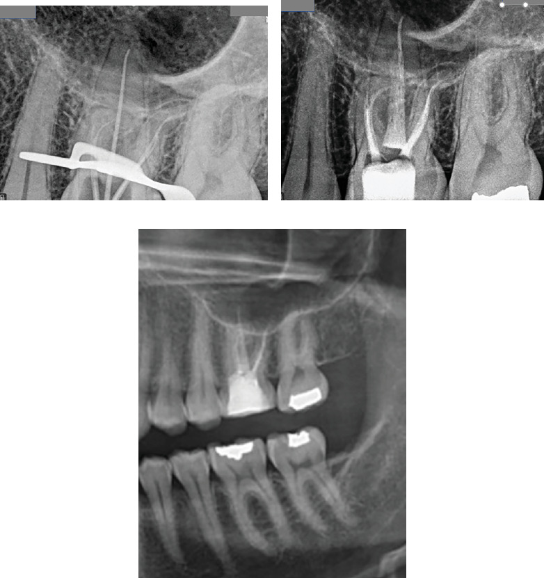 Figure 16