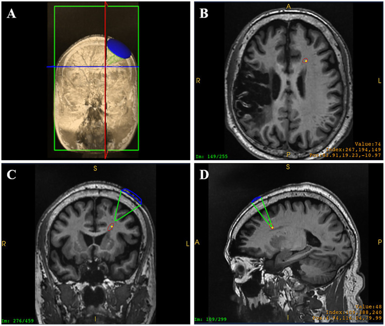 Figure 4