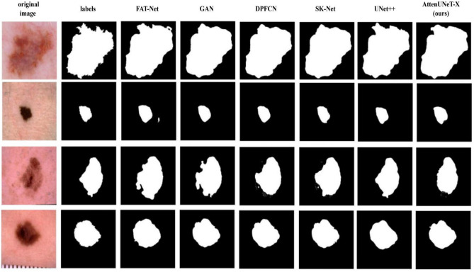 Figure 11